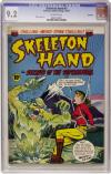 Skeleton Hand #3